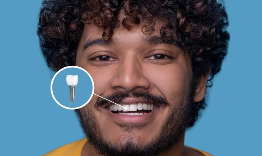 dental implant longevity