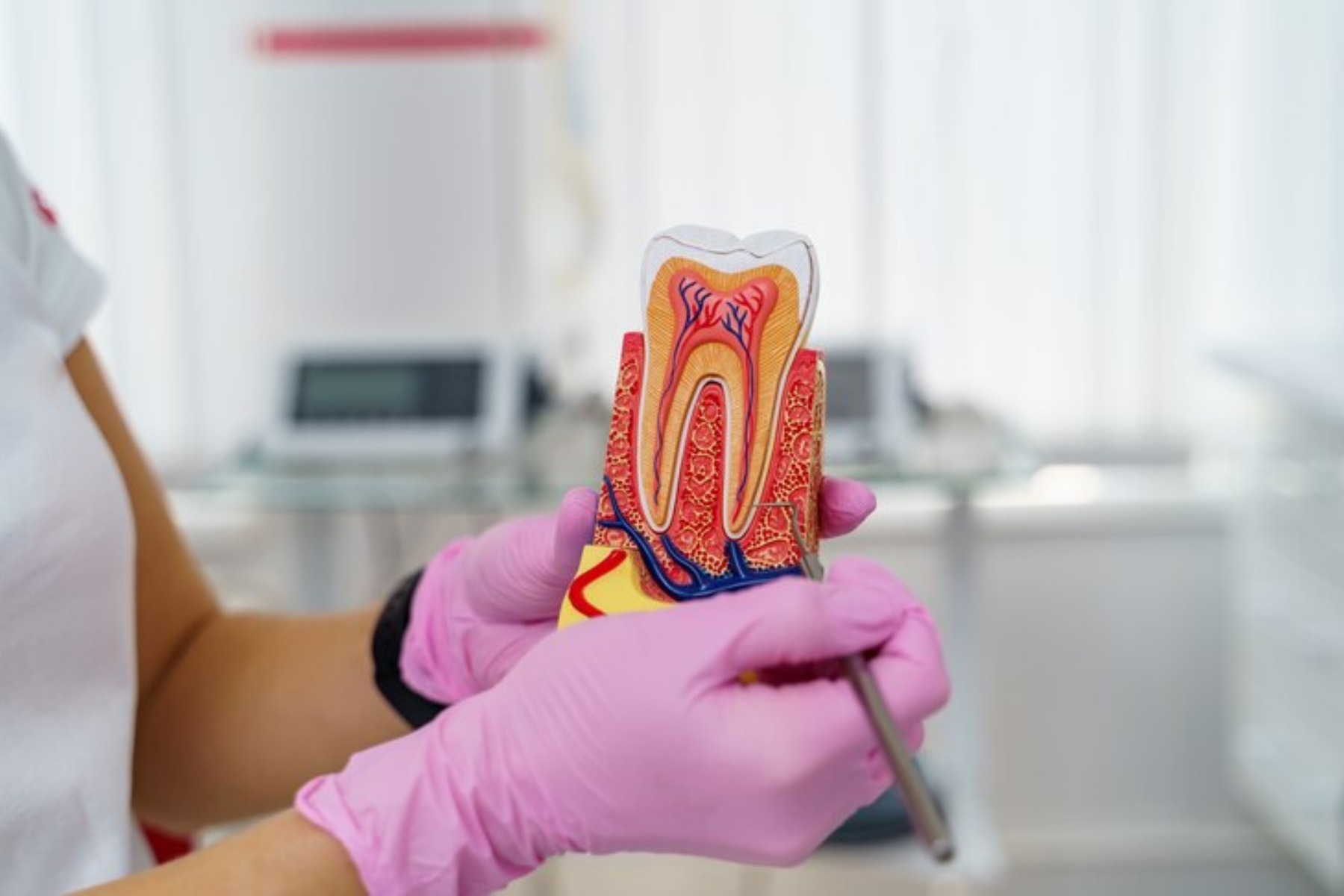 essential tips after root canal therapy