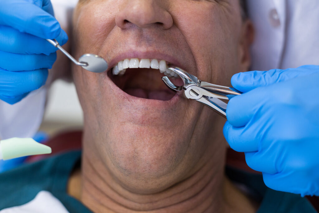 discover 6 essential tips for a smooth tooth extraction