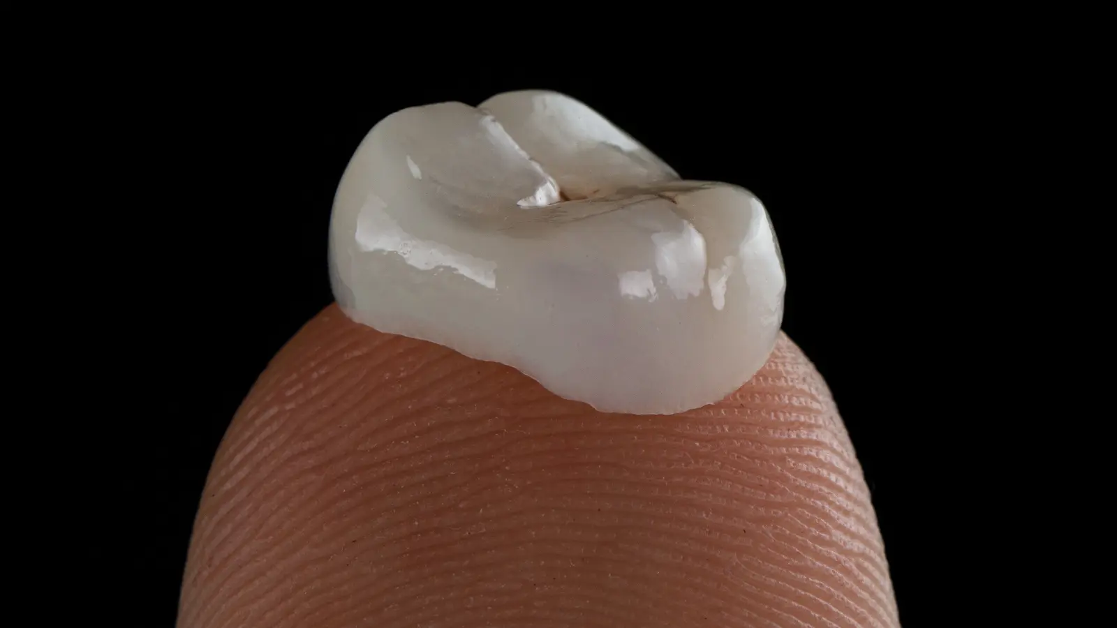 What Are Dental Crowns