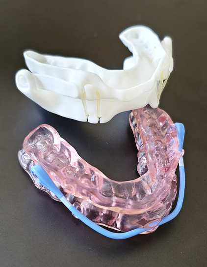 General Dentistry in California